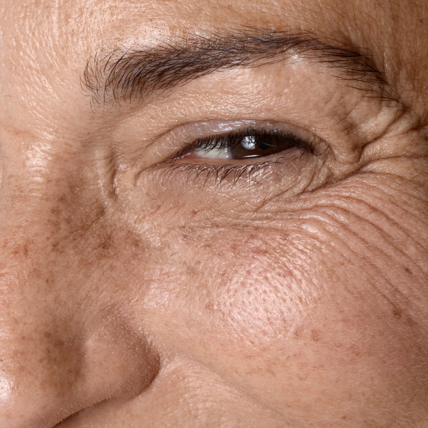 Dysport-Reserve your spot