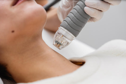 Microneedling (Face & Neck)