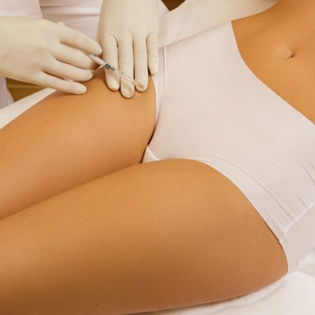 PRP Vaginal