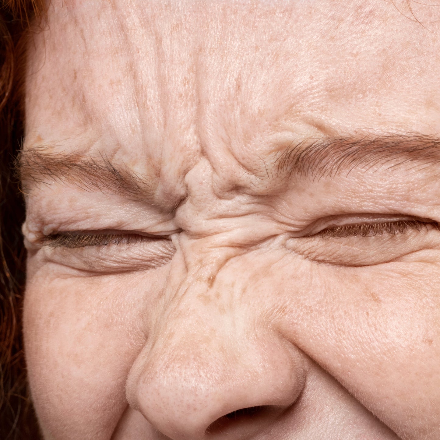 Xeomin - Reserve your spot