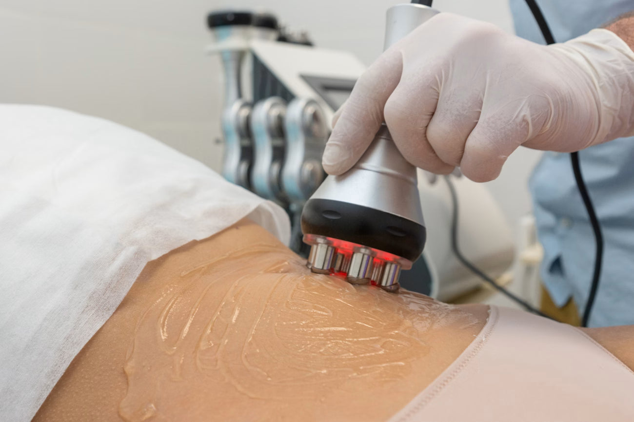 Radiofrequency